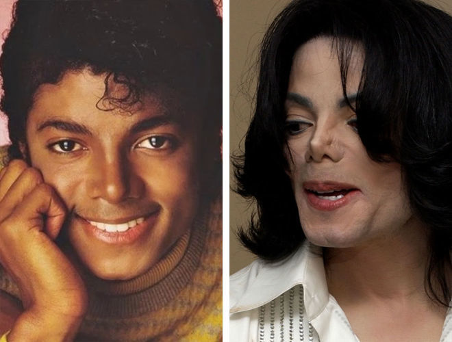 Майкл Джексон до и после ринопластики